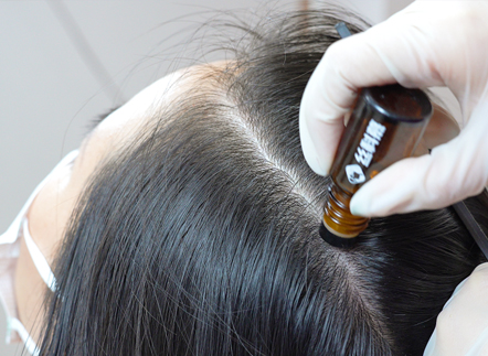 The new benchmark of scalp micro-ecological