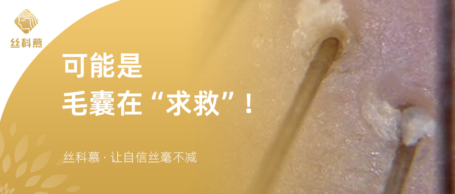 毛孔堵塞影响皮脂排泄，竟会引起这些头皮问题！